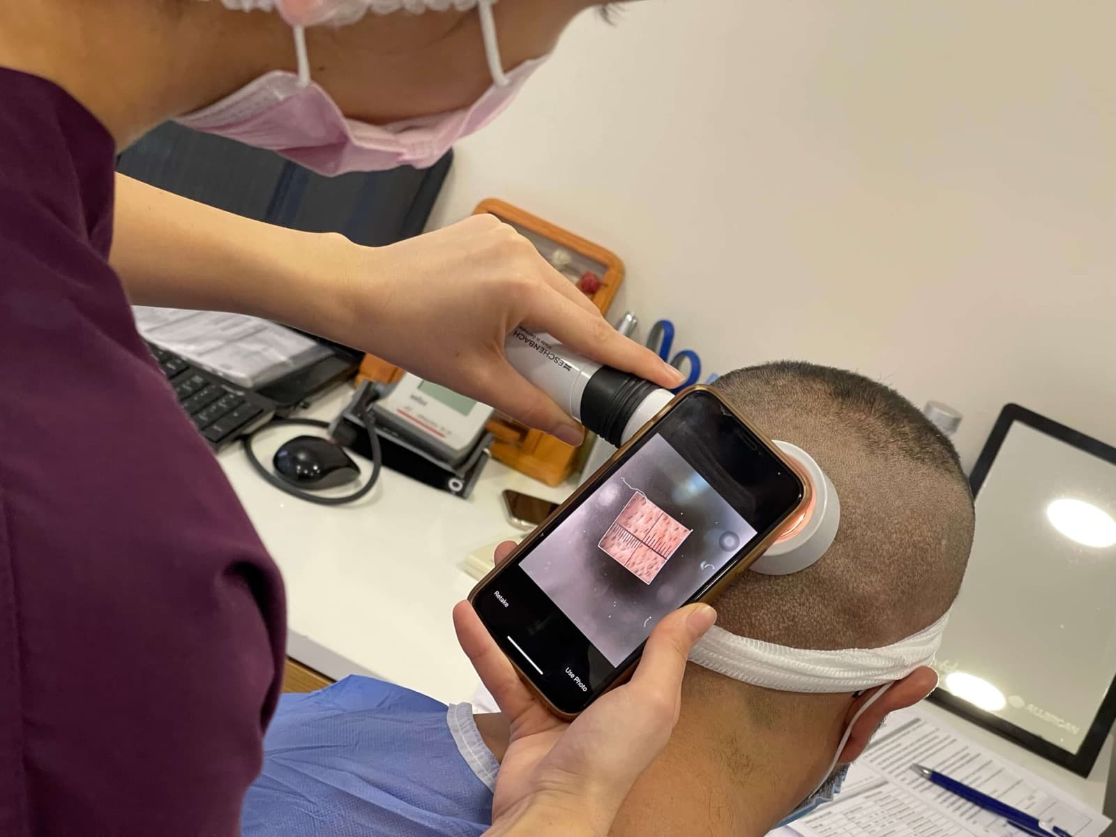 A DK Hair Klinik specialist examining a patient’s scalp with a magnifying camera
