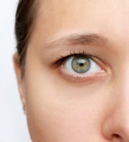 Before: Blepharoplasty, Antalya, Türkiye